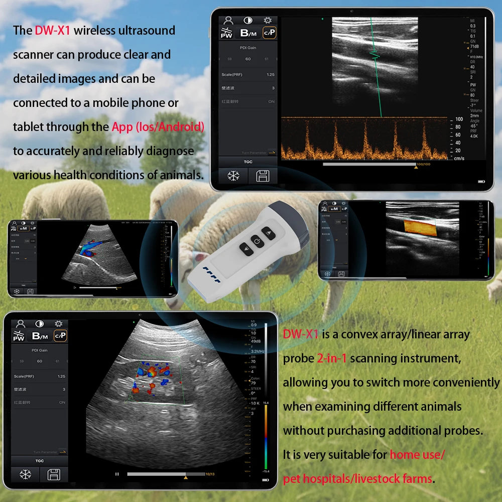 Wireless Color Doppler Ultrasound Scanner 2in1 Convex & Linear Probe