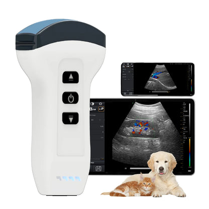 Wireless Probe Color Doppler Ultrasound Scanner Portable