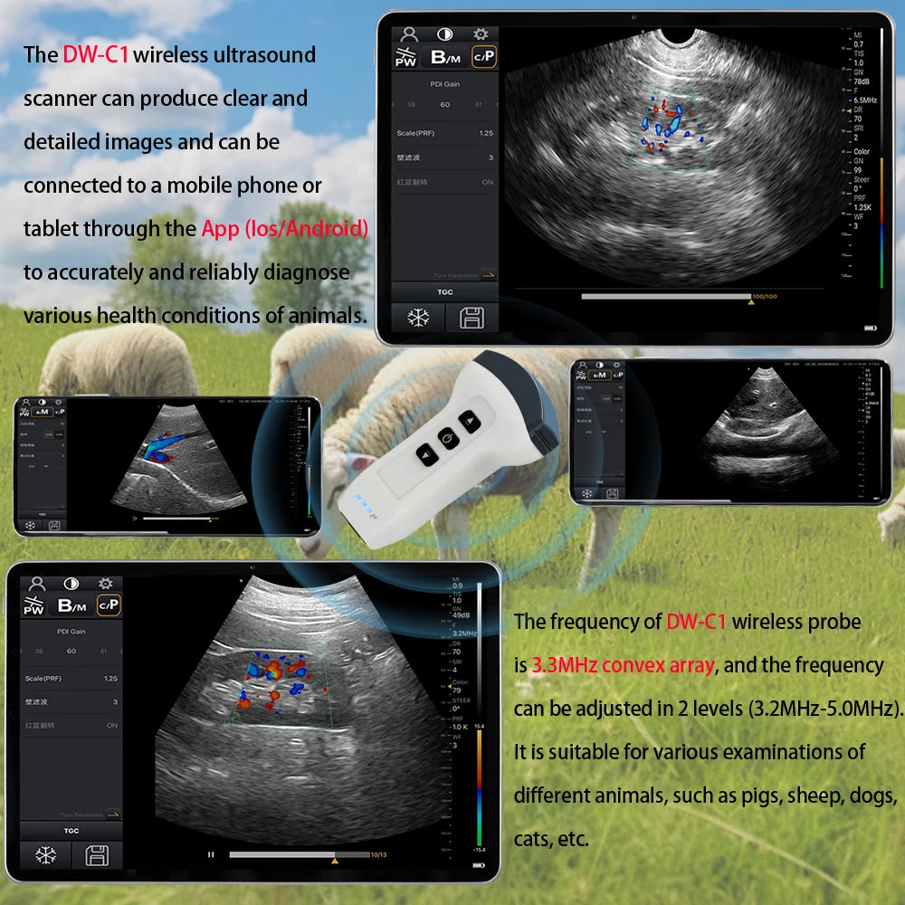 Wireless Probe Color Doppler Ultrasound Scanner Portable