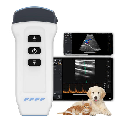 Wireless Color Doppler Ultrasound Scanner 2in1 Convex & Linear Probe
